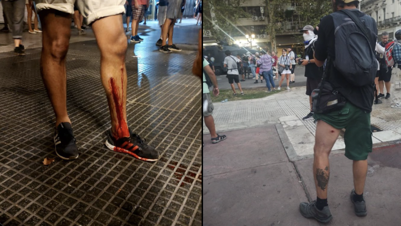Argentina: al menos 27 trabajadores y trabajadoras de prensa fueron heridos en la cobertura de las movilizaciones